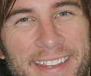 Teeth Whitening: Professional Options for a Brighter, Younger Smile
