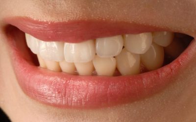 Complete Guide to Dentures in Cookeville, TN