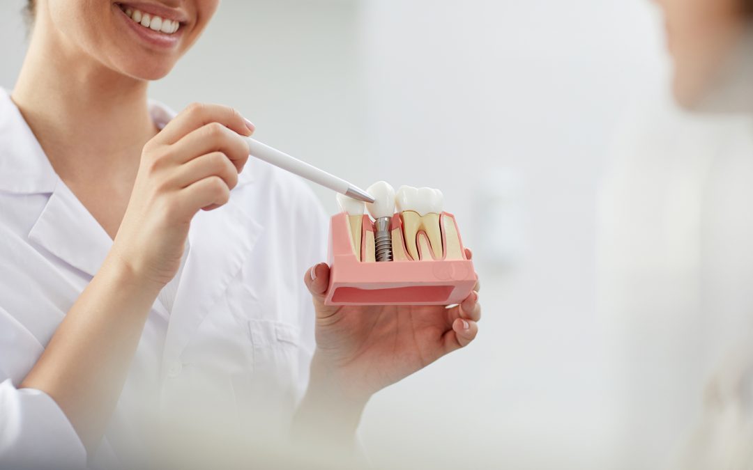 How Safe Are Dental Implants? A Guide for Cookeville Patients